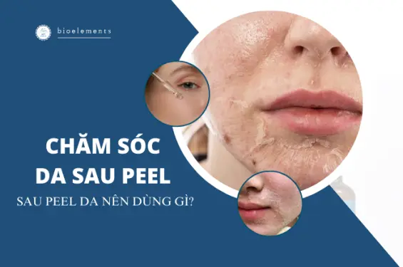 Chăm sóc da sau peel: Sau peel da nên dùng gì?