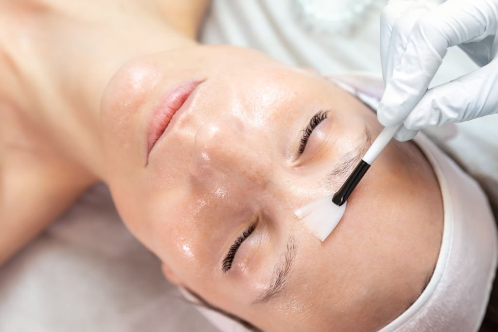 Điều trị mụn ẩn bằng phương pháp khoa hoc