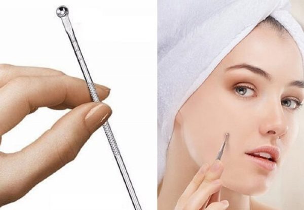 Các bước nặn mụn ẩn ở má tại nhà