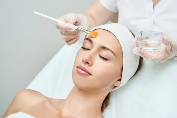 Peel da điều trị mụn là gì